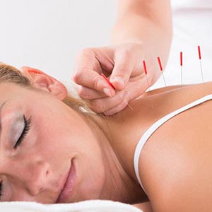 acupuncture at Center for Natural Medicine in Eagle River